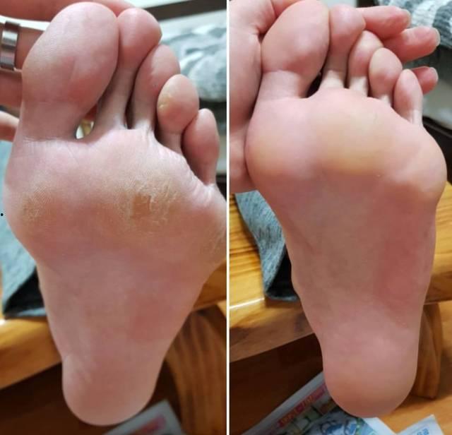 明星歪脚,意外走红，网友热议不断