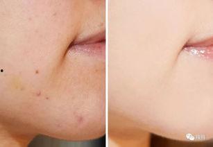 遮瑕刷明星同款,揭秘遮瑕刷界的明星同款神器