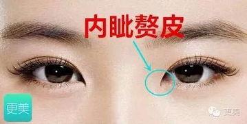 内眦赘皮好看的明星,盘点那些因独特特征而更显风采的明星