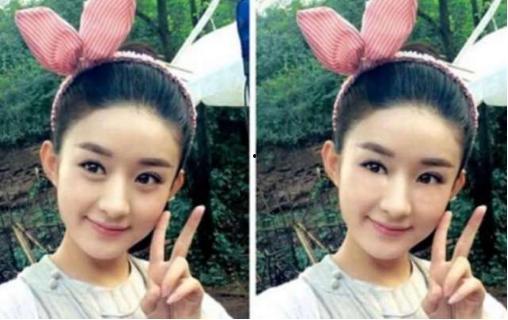 有无卧蚕区别明星,揭秘卧蚕与无卧蚕明星的差异化魅力